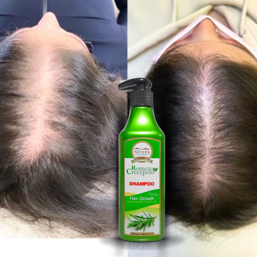 SHAMPOO CRECEPELO
